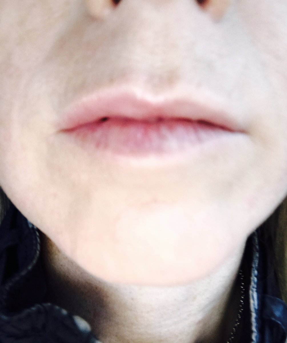 Rach__78's tweet photo. I absolutely love this Plumping Lip Balm. #doeswhatitsays #halflipchallenge https://t.co/vVdN5Olh8K