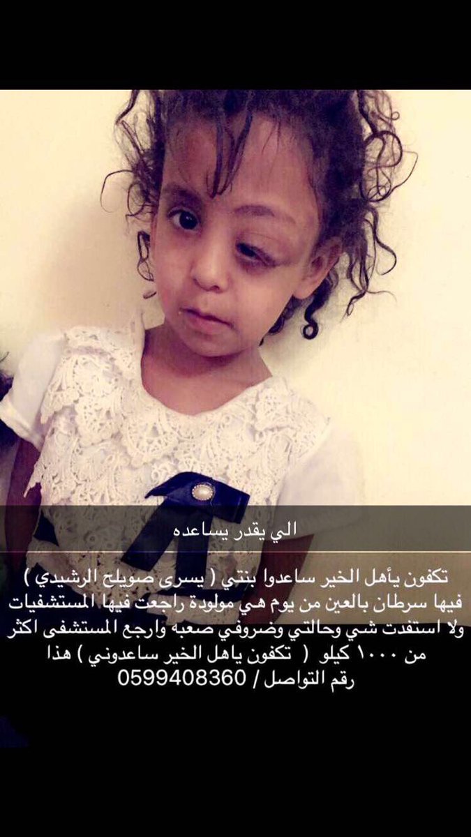 نقدر نساعدها والله رتويت منك يفيد