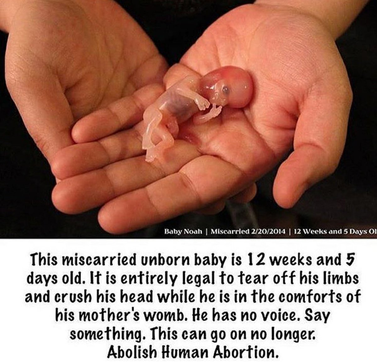 ANA4PEACE2016's tweet photo. THIS IS WHY WE ALL NEED TO #DEFUNDPlanParenthood
IT IS TO HELP THOSE WOMEN WHO WANTS FREE ABORTIONS!π
#SoWrong
@ANA4PEACE2016
@POTUS
#MASA https://t.co/qZ8X7mOqPR