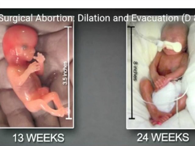 ANA4PEACE2016's tweet photo. THIS IS WHY WE ALL NEED TO #DEFUNDPlanParenthood
IT IS TO HELP THOSE WOMEN WHO WANTS FREE ABORTIONS!π
#SoWrong
@ANA4PEACE2016
@POTUS
#MASA https://t.co/qZ8X7mOqPR
