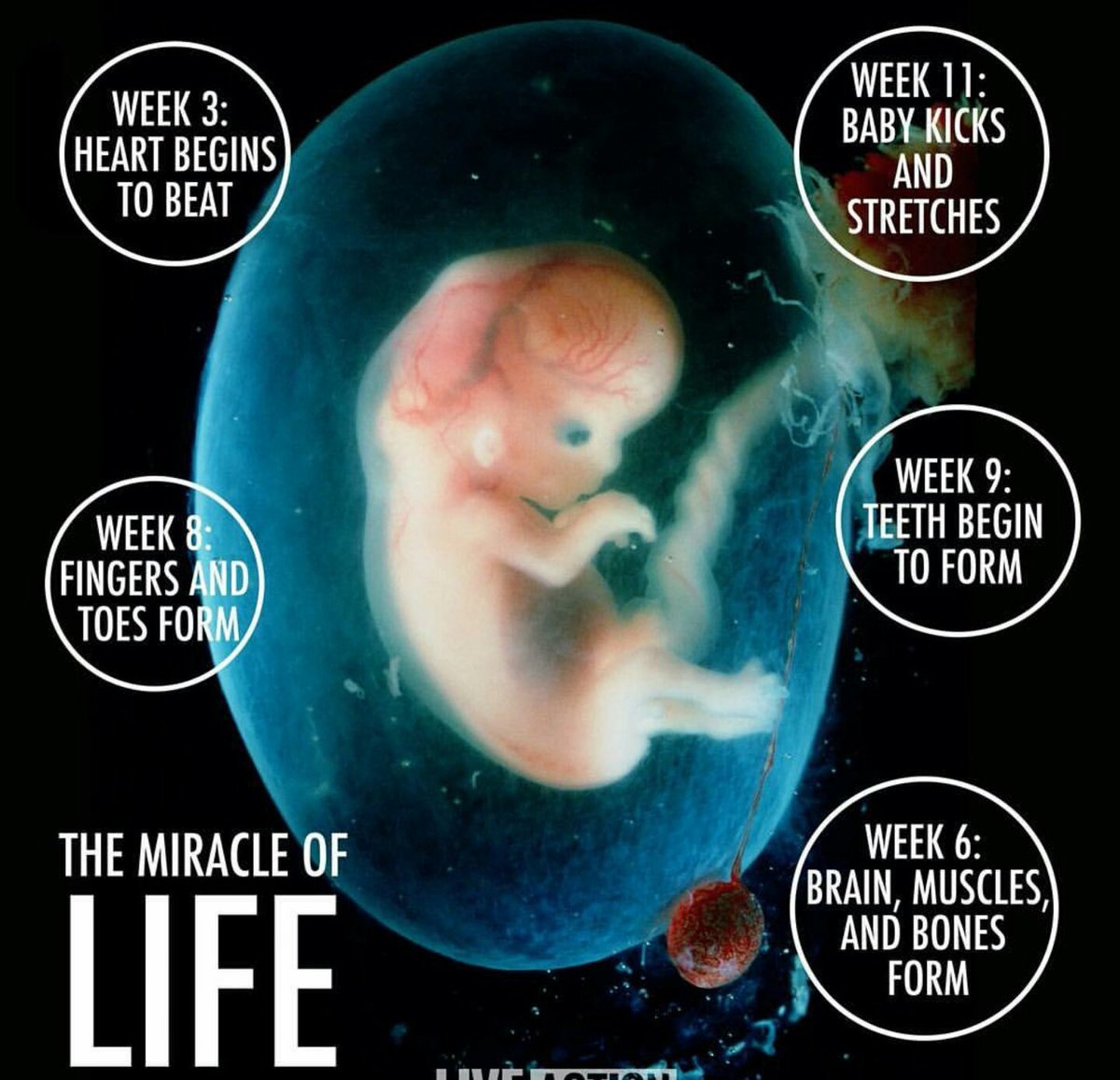 ANA4PEACE2016's tweet photo. THIS IS WHY WE ALL NEED TO #DEFUNDPlanParenthood
IT IS TO HELP THOSE WOMEN WHO WANTS FREE ABORTIONS!π
#SoWrong
@ANA4PEACE2016
@POTUS
#MASA https://t.co/qZ8X7mOqPR