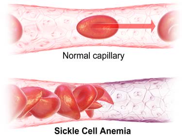 EU_HomeRemedies's tweet photo. European Natural Remedies For Anemia 
#naturalhealing #healthyliving #natura ... https://t.co/0xrqm3TC6E https://t.co/Pyna9mrnQl