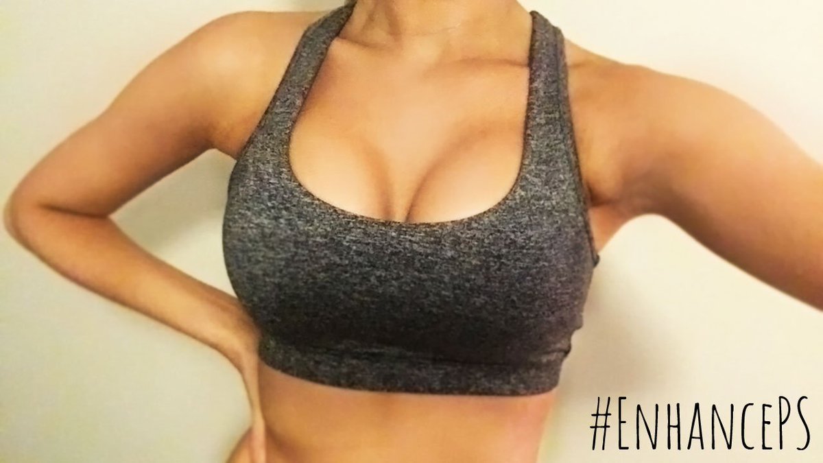 Enhanceps's tweet image. Patient pic// Post workout gym selfie - irresistible! #boostedbydrbroady
#drbroady
#broadhurstbabe