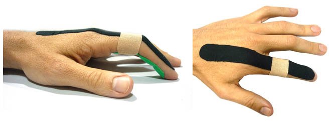 Temtex_Es's tweet photo. Nueva Técnica de #Kinesiotaping para Curar las Lesiones Leves de Dedo https://t.co/1AuI77qOG8 #Temtex https://t.co/Df0doAFSvl