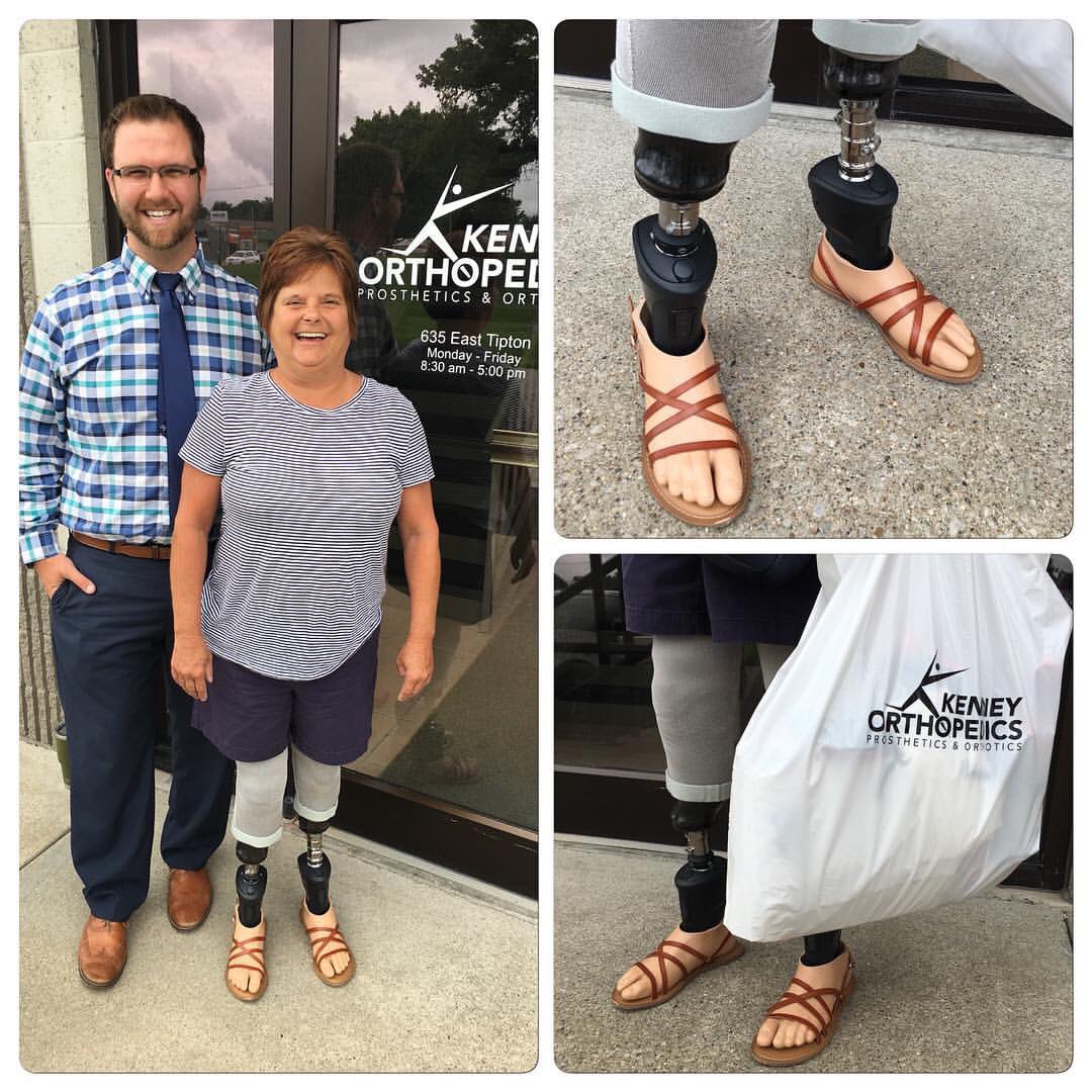 FreedomInnovate's tweet photo. Equation of the day: #Kinnex x 2 = happy patient + happy clinician!
via @Kenneyortho
#freedominnovations #prosthetics #MPCTechnology https://t.co/lQBUUKxpz0