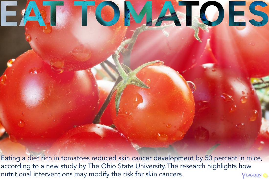 LagoonHospitals's tweet photo. Eat Tomatoes #Tomatoes #Nutrition #Health #Advuce #Reasearch #WednesdayWellness https://t.co/iXUi2GLgEr