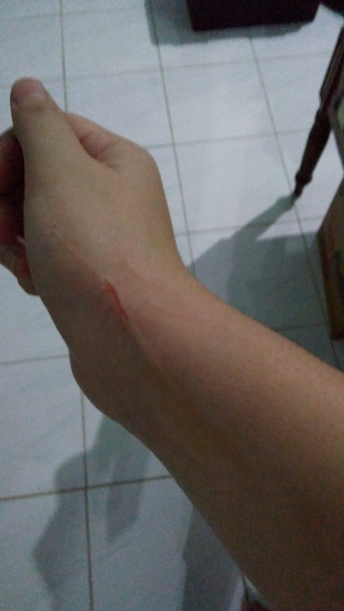 atikaharifah's tweet photo. Cat person problem: lagi main kena cakar

Millennial problem: sempet2nya update 😂😂 https://t.co/6EEYsJYwzb