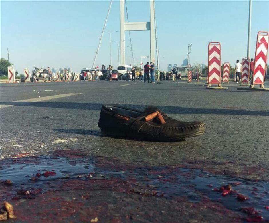 Bu vatan,canı pahasına kendini tankların mermilerin önüne atan asil milletindir

#HayattanÖğrendiğim tk sey;
#15 Temmuz
#Unutma
#unutturma