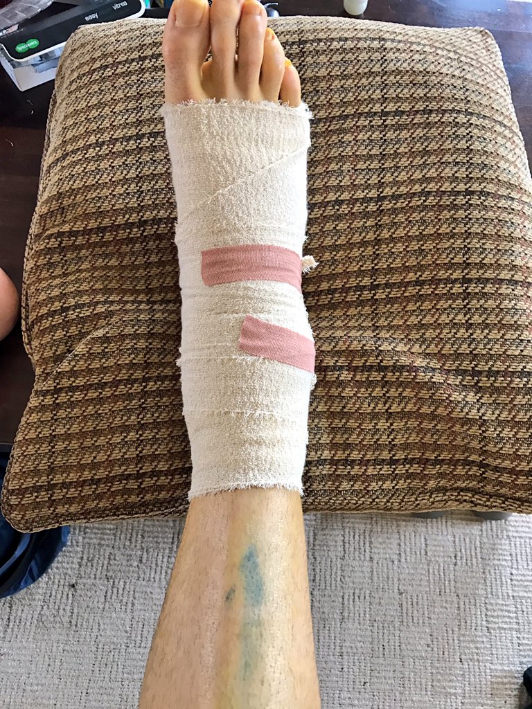 jamesfinney7's tweet photo. Ankle operation number 4 complete with @yorfac #BackOnTrack #Rehab #DecDecDec #YellowFeet π₯πͺππͺ https://t.co/1EZg5dANGc