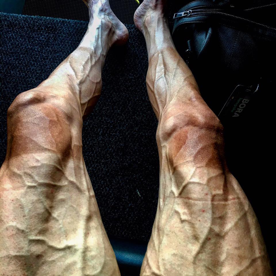 amantes_cycling's tweet photo. Las piernas de Paweł Poljański tras 16 etapas del  #tdf2017. Via  @8aldwin https://t.co/OJwuoHoILL