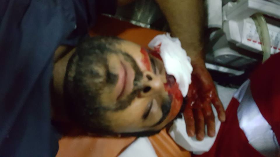 palinfoen's tweet photo. Breaking from Al-Aqsa: More pictures of Palestinians injured by Israeli occupation troops blockading Al-Aqsa Mosque. #البوابات_لا
#freeQuds https://t.co/mZ36CWjaSn