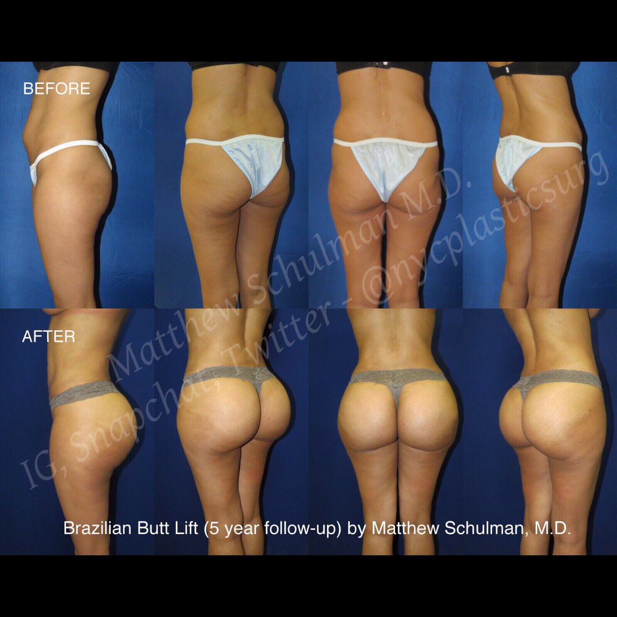 Brazil Butt Lift Workout Challenge Pack Special