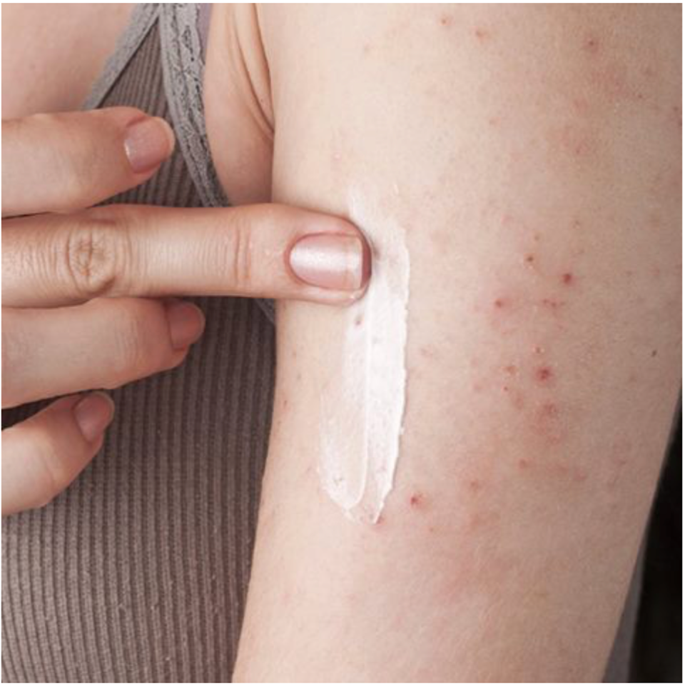 Tallowderm's tweet photo. ECZEMA:

Dr. Cowan, (SF, CA) recommends #Tallowderm!

Follow the simple protocol on our website to help bring your eczema under control! https://t.co/3Qcvobhhyb