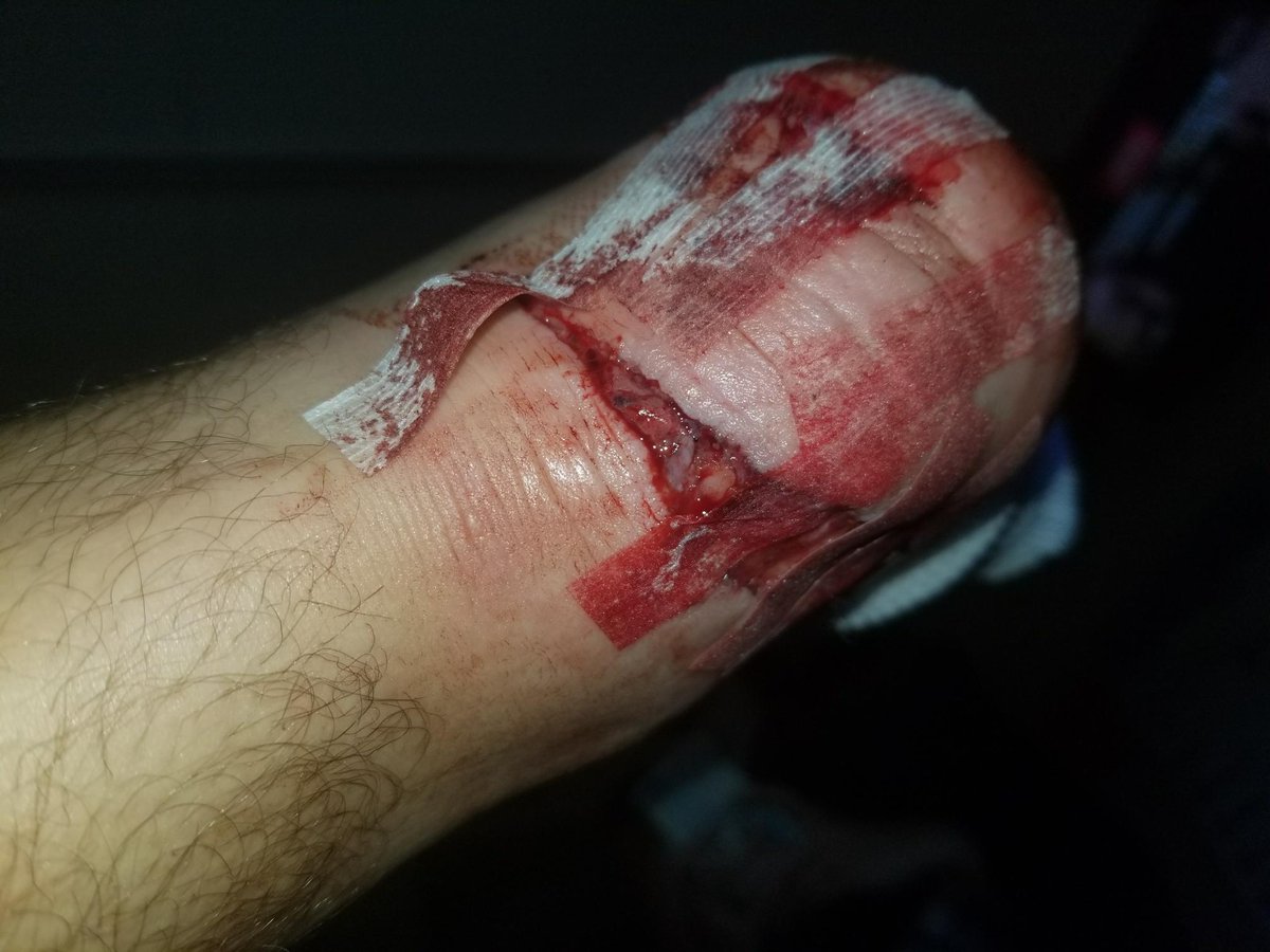 Collin_12_'s tweet photo. Always wear boots while riding a motorcycle guys. Also never trust anyone 😕 https://t.co/CX95AHfkKP