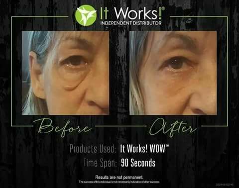 darkangel420's tweet photo. Omg!! This stuff is like liquid gold!! Wipes out wrinkles, under eye bags and puffiness in 90 seconds!!!No joke!!

Perfect #MakeUpPrimer https://t.co/Vf06N8y1LE