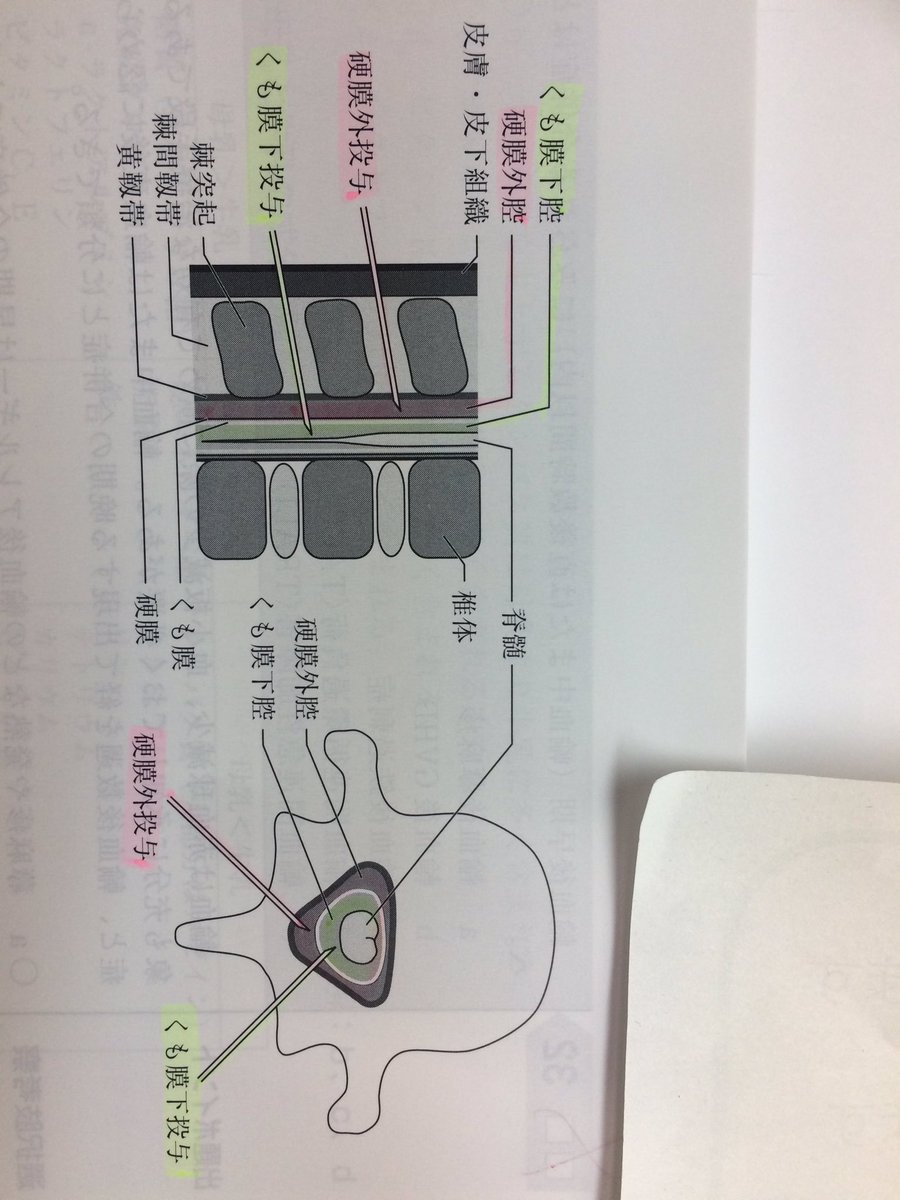 下 脊椎 麻酔 くも膜