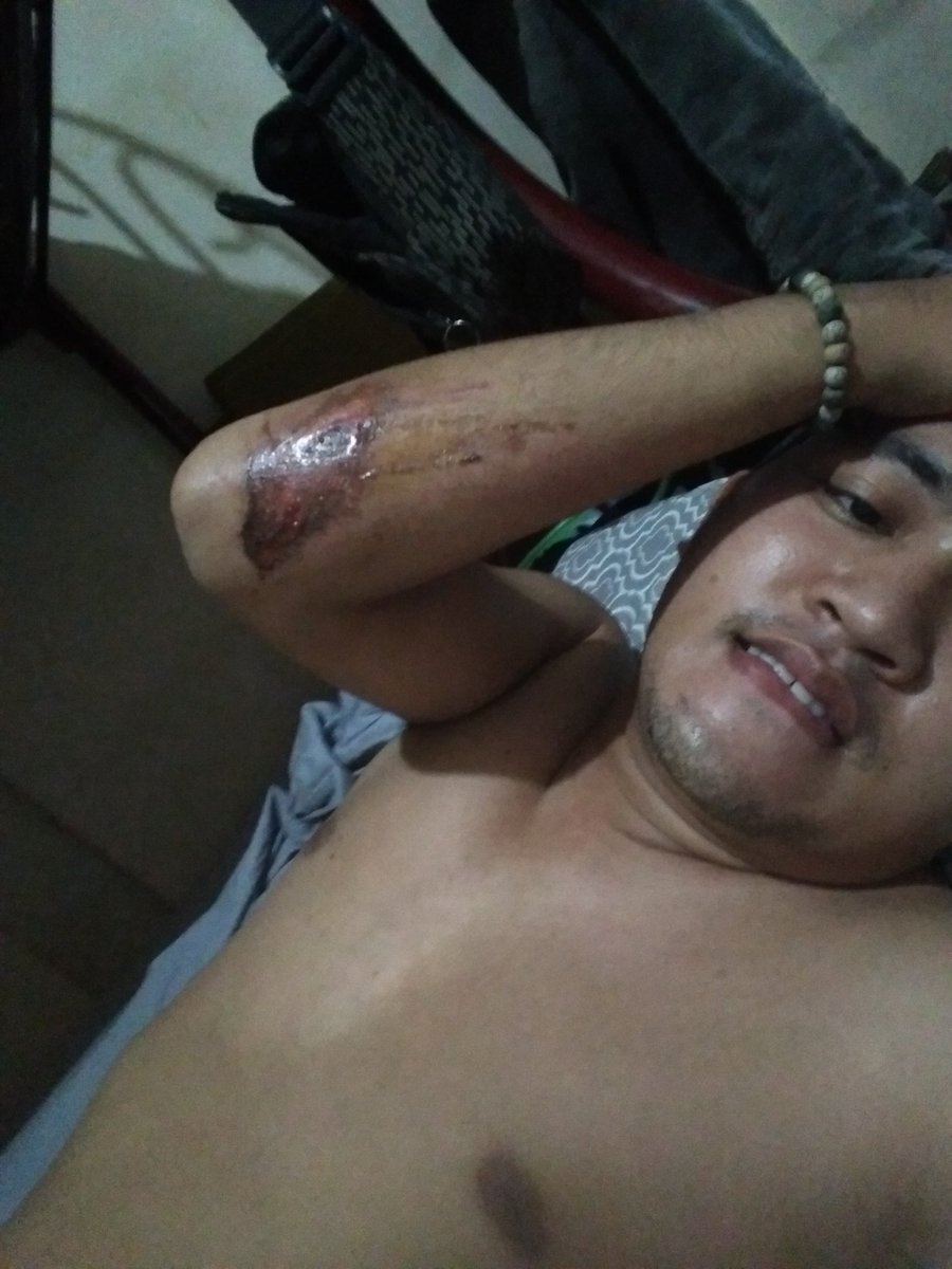Brex6666's tweet photo. Aray hapdi talaga. https://t.co/QL2JmIlyT6