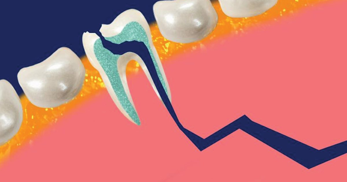 Chesterfielddmd's tweet photo. READ THIS ARTICLE to find out why it’s so important to prevent cavities or deal with them ... https://t.co/cWJjc5FWht https://t.co/QElhe58iKv