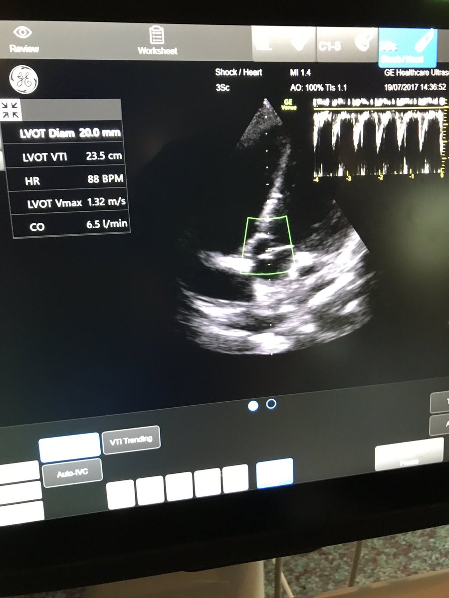 emuss_uk's tweet photo. 5seconds to find out CO. #GEVenue @jrobi09 @lauraellen115 @WINFOCUS @PhilipUK3 @UAE_ESEM @echo_urg @pocusireland #PNCUS https://t.co/pqDK4NG7pX