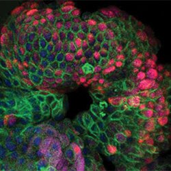 GurdonInstitute's tweet photo. Huch lab wins new NC3Rs project grant to model human liver cancer in vitro with organoids derived from tumour biopsy https://t.co/BtqQmC1lpC https://t.co/gxucjEysQu
