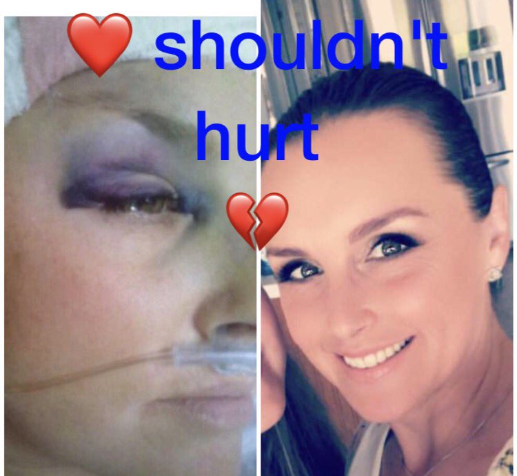 Rachel_SUTDA's tweet photo. Keep encouraging those silent victims to speak out about domestic abuse. There is no shame about being a victim, the shame is on the abuser https://t.co/3ogzTSvSNV