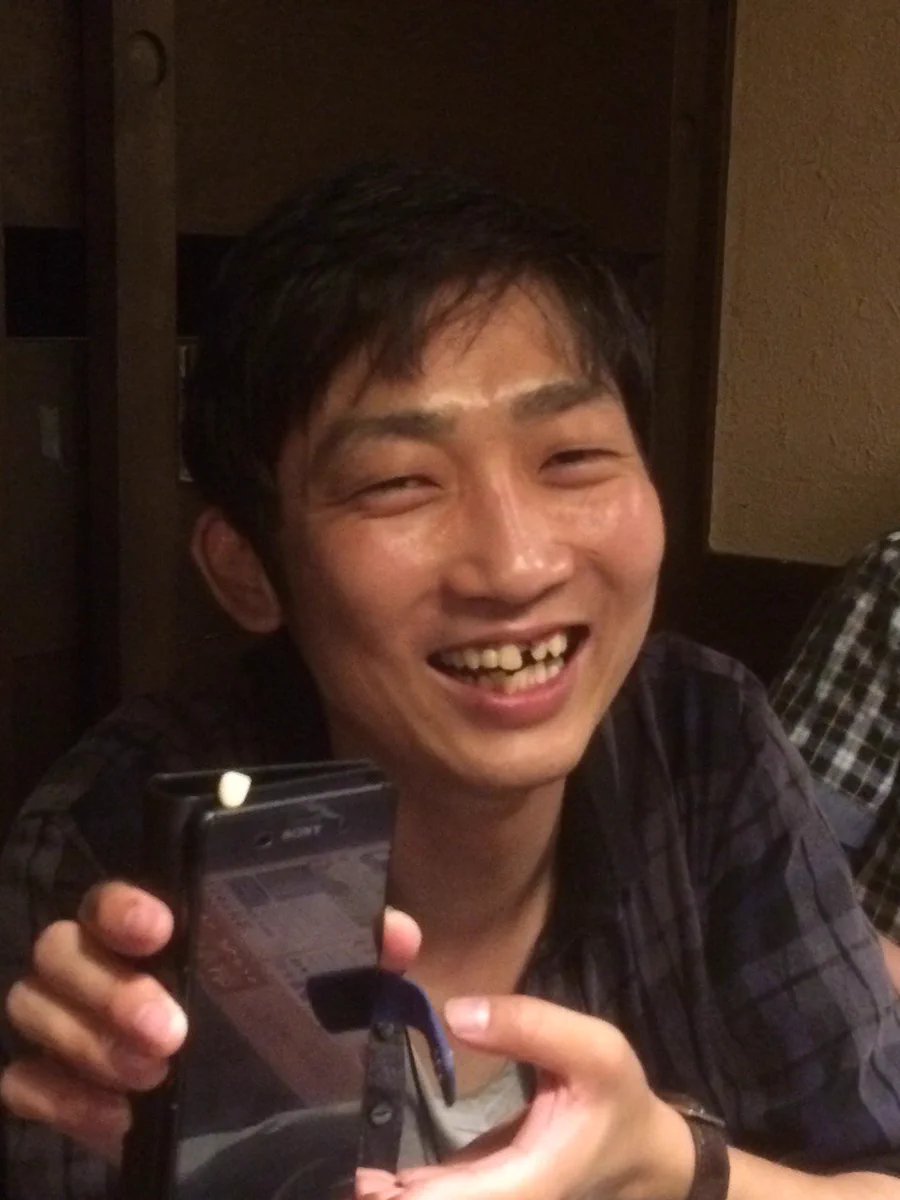 病欠な石田くんww歯まで抜けてしまうなんてなんだか悲しいww