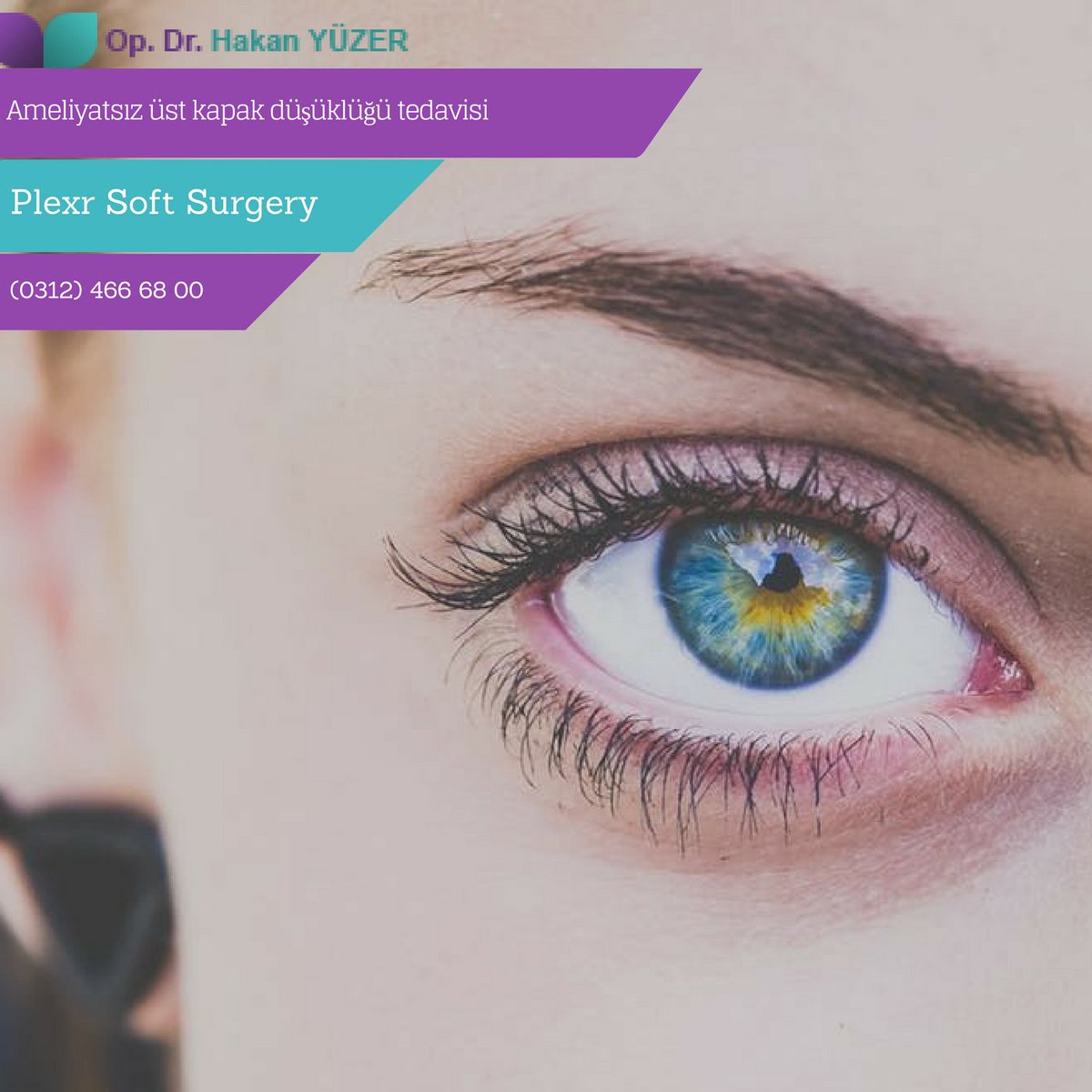 Dr_HakanYuzer's tweet photo. Ameliyatsız üst kapak düşüklüğü tedavisi-Plexr Soft Surgery👨‍⚕️
#plexrsoftsurgery
#ankara https://t.co/BZItnqtW2L