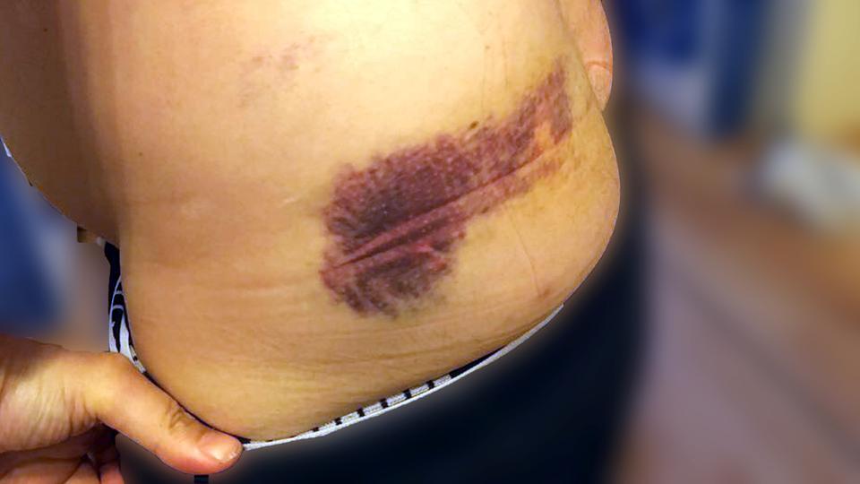 g20_doku's tweet image. Neues Ereignis: Schläge und Tritte gegen einen Unbeteiligten #g20 #polizeigewalt g20-doku.org/2017/07/07/sch…