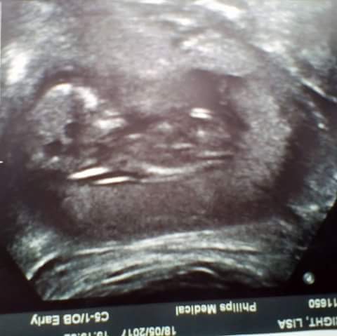 mattjames2017's tweet image. Our beautiful little boy cant wait to meet you son xxxxx #happytimes #daddy