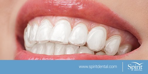 Spirit_Dental's tweet image. Contrary to #popularbelief, while #teeth don't grow back, they can do go through #remineralization to fix #demineralised enamel.