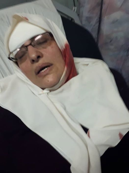 palinfoen's tweet photo. Breaking: Israeli troops brutally attack Palestinian worshippers and injure dozens in occupied Jerusalem near blockaded Al-Aqsa gates. https://t.co/mkYIZtX36c