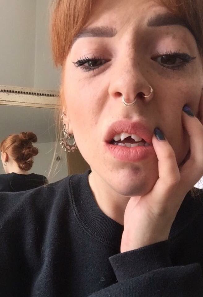 Revalationn_'s tweet photo. You know it's a good night when your mate breaks her front teeth! #PoorSteph what a mad night in Nottingham though! On a Wednesday... ๐๐๐ผ https://t.co/VuU5Fw2Upp