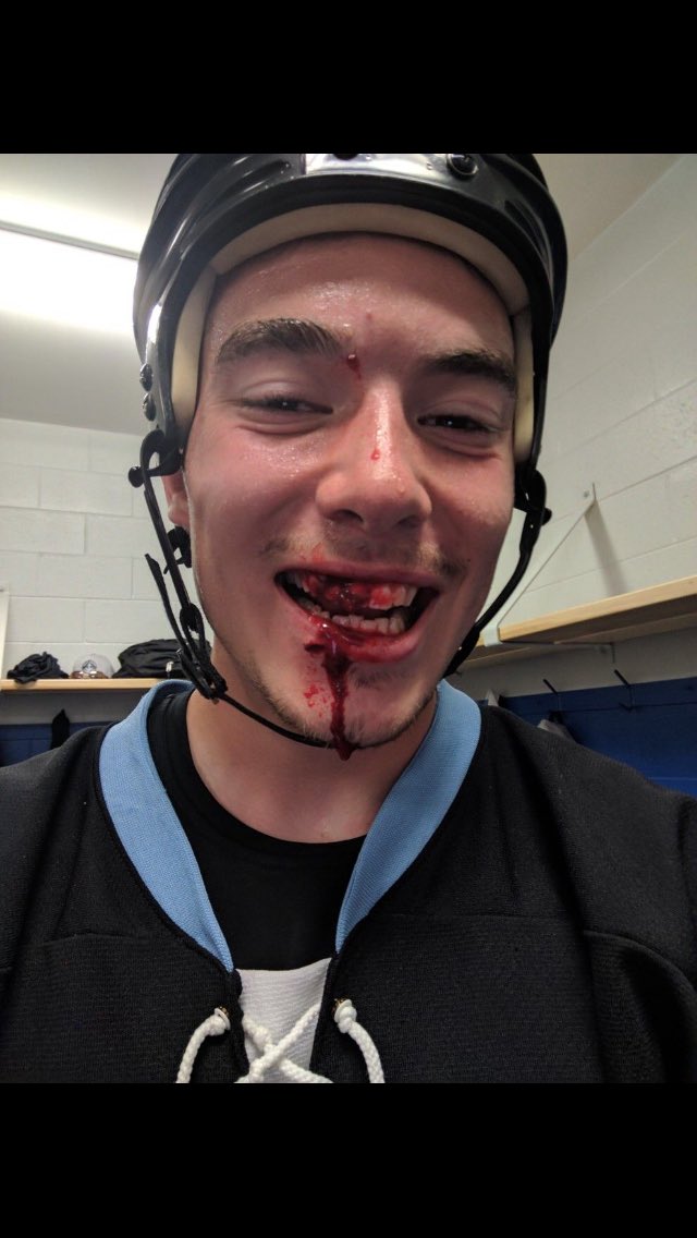 EvolutionBHC's tweet image. We fall to 0-1 after a 5-3 loss to @daaRooks , back in action tomorrow at 1:00 pm AT. #FairCalls