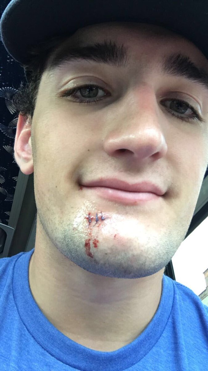 Dennis_Gilbert8's tweet photo. Added a little fiber to my diet today at @NHLBlackhawks development camp. #Crunchy 🏒 https://t.co/kJ5RrakiKC