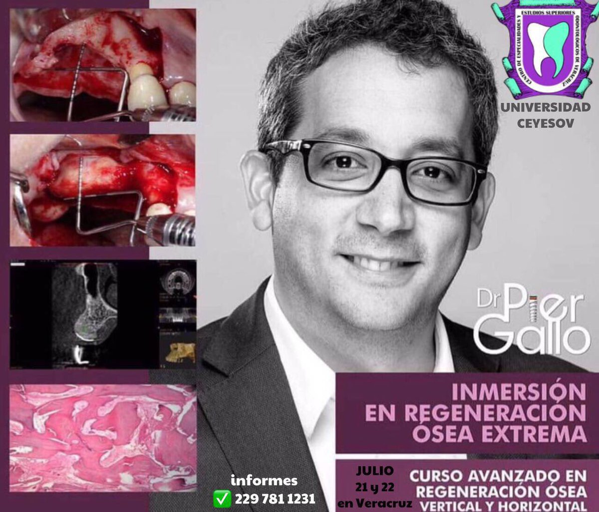 CEYESOV's tweet photo. Curso 21 y 22 julio CEYESOV https://t.co/5du39Otx6F