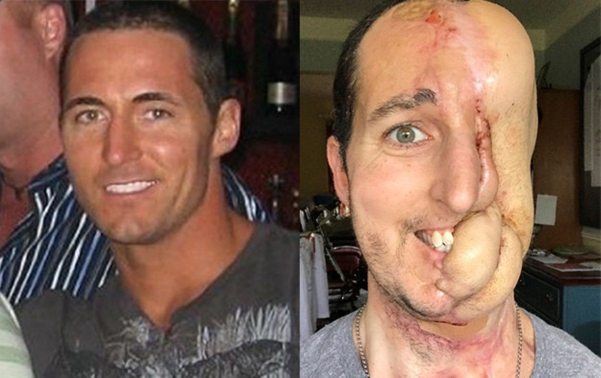 woogeneli's tweet photo. Man Lost Half His Face to #Cancer! #graphicmedicine https://t.co/X4iVTtehYj https://t.co/bNnFm1ECbx