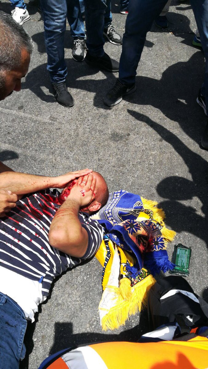 HurEkipIstanbul's tweet photo. Siyonist israil, Müslümanlara saldırıyor. Onlarca yaralılar var! 
#AksaİçinTekSes olduk olmaya mecburuz. https://t.co/n2Qm9YZinI