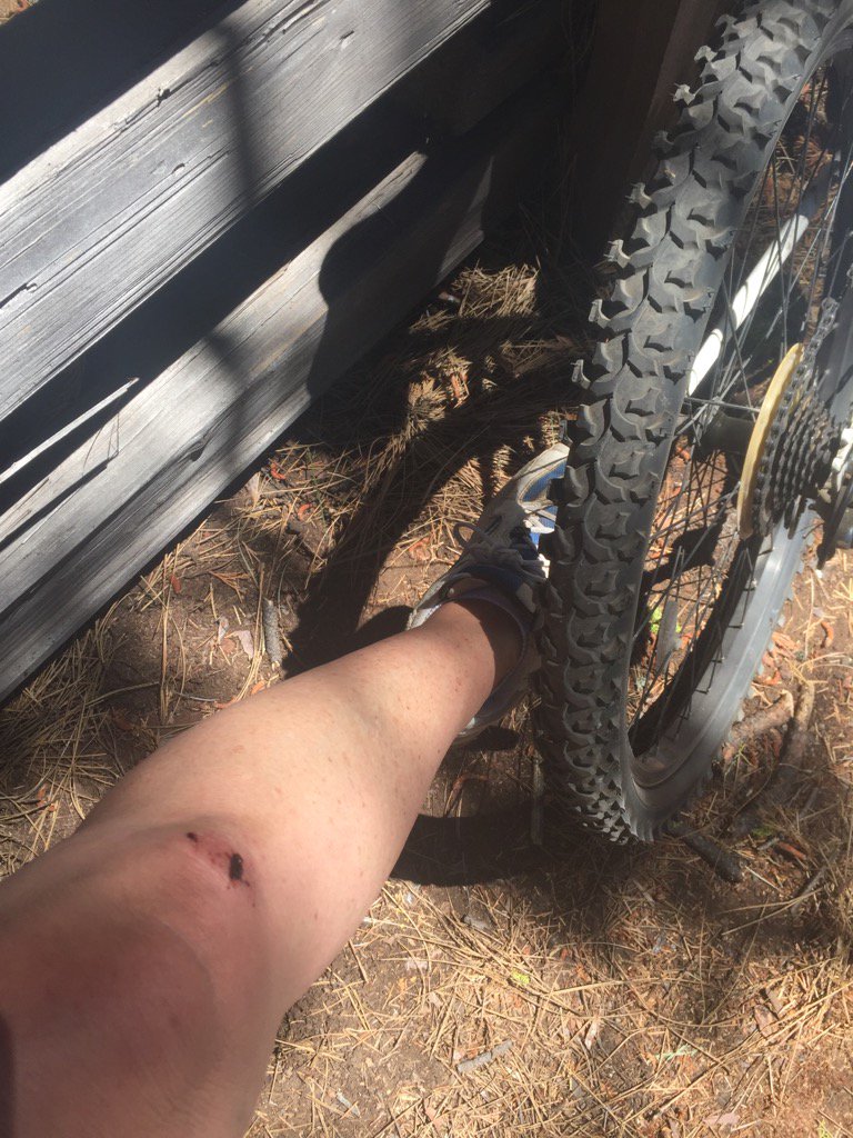 karennau's tweet photo. When life knocks you down, just get back up and dust yourself off!! #bikeriding #vacation #BurneyFalls #scrapedknee https://t.co/OqFtcbuIJN