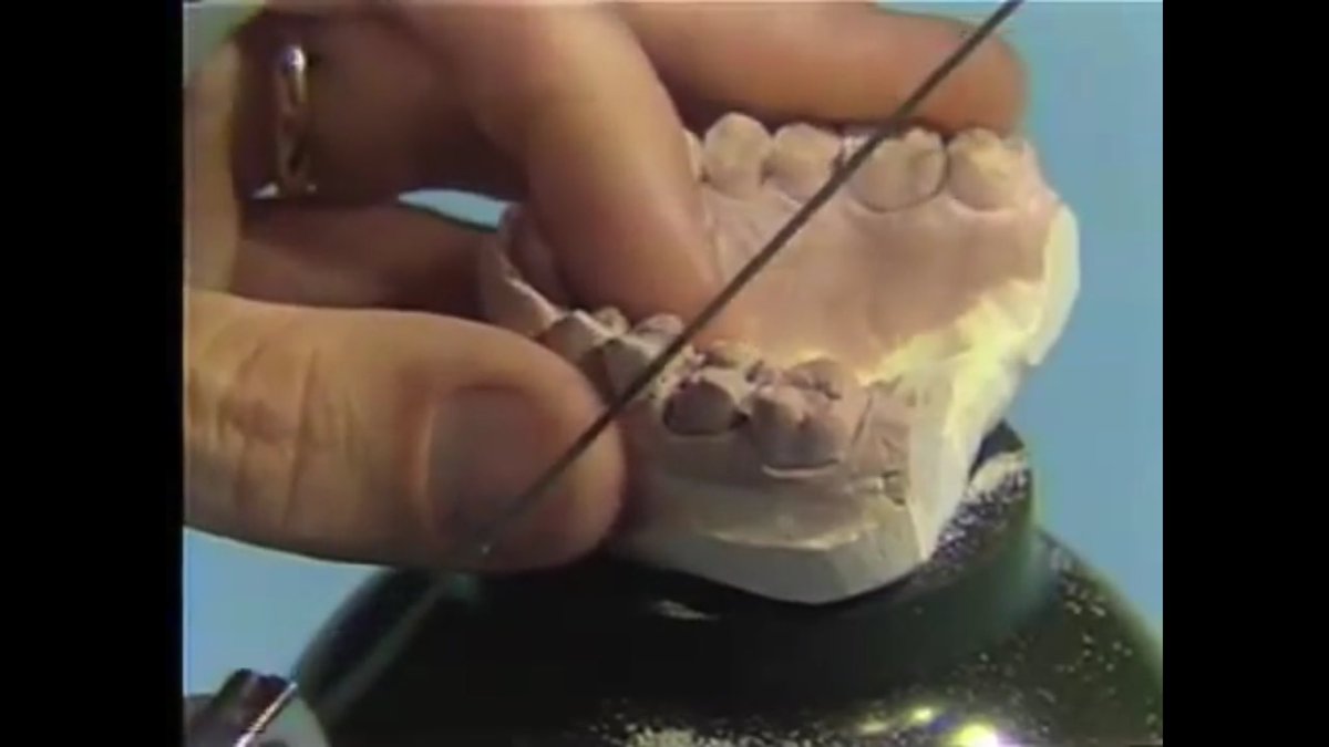 dr_shaughn's tweet photo. Thanks @UMichDentistry for this gem from the 70's on how to fab a #die and cast! https://t.co/7fYq1ssLB4  @open_michigan 😷#danielsnyderdds https://t.co/GQj8BQW6LT