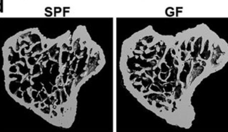 BiotechHoldings's tweet photo. Mice grown in germ free conditions with no microbiome have stronger bones than those with normal #microbiome 

https://t.co/hoR6QrYFqA https://t.co/C2M1mXNeUE