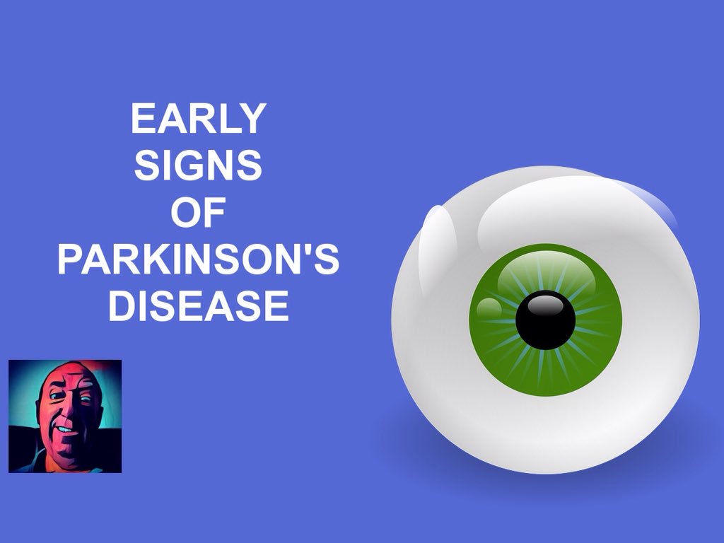 ianfrizell's tweet photo. #earlysigns of #parkinsonsdisease https://t.co/5oDIMVRxmK #parkinsons #yopd #visualdisturbance #parkinsonsawareness #tremor #anxiety https://t.co/ka8w8vkjrF