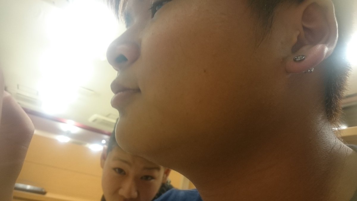 madamada1406's tweet photo. あれこうせいのあごから。。爆笑 https://t.co/GBGY20yzmH