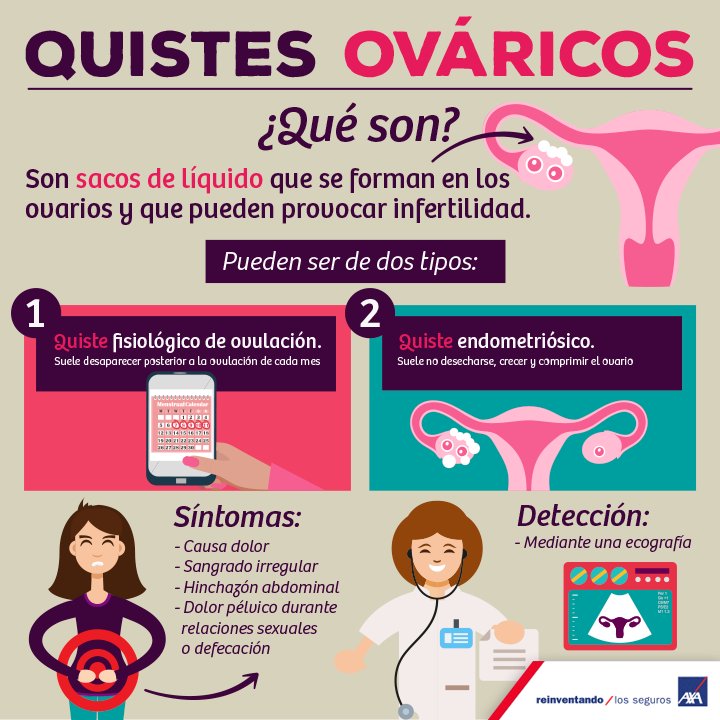AXAMexico's tweet photo. ¿Sabes qué son los quistes ováricos? Si eres #mujer esta información te interesa.
#AXAteCuida https://t.co/W1R3vpVH6A