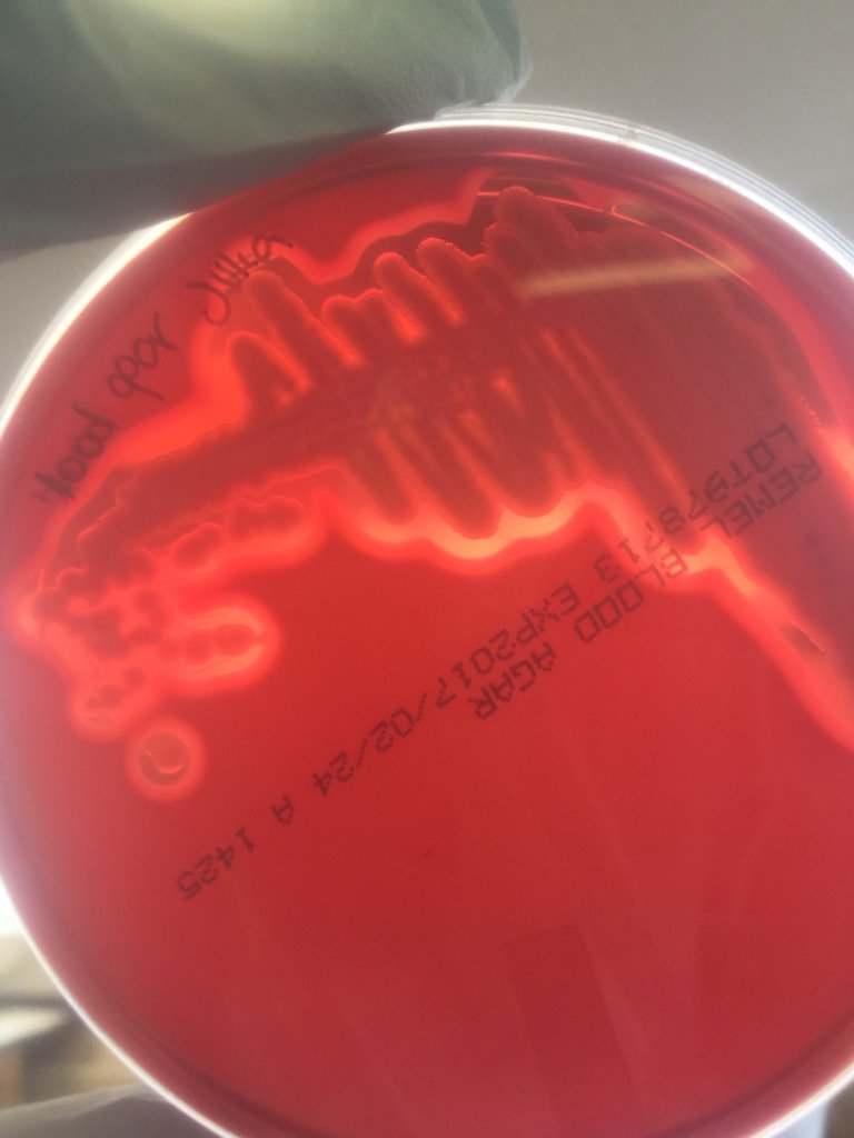 julilumariposa's tweet photo. @Team_SWI @UConnSWI #SWIPIs2017 look at that beauty. Blood agar. https://t.co/aOqE1aYZ6r