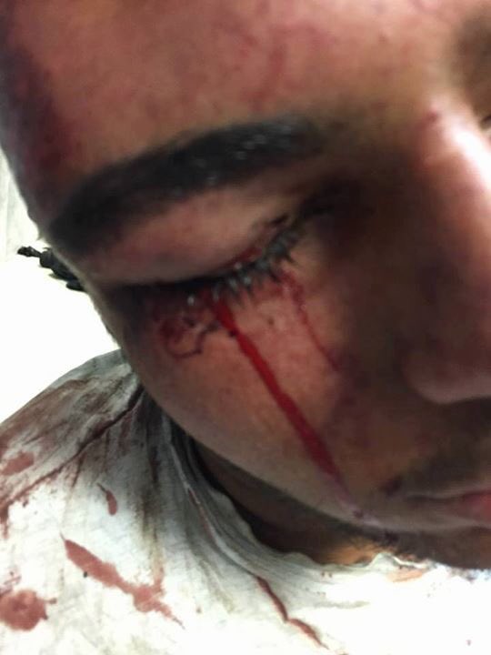 AbbsWinston's tweet photo. Palestinian teen Mu'taz Sa'ida, 18, was cuffed, strapped on chair &amp; brutally beaten by Israeli Occupiers til blood poured down from his eyes https://t.co/rGyZHvIhuD
