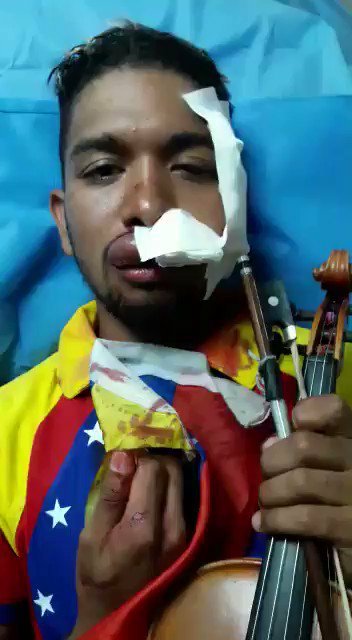 Gato_Vzla's tweet image. Nuestro Willy recuperándose!
.@DolarToday 
.@HDPY0 
.@LucioQuincioC 
.@antenax2 
.@YoSoyJustin_