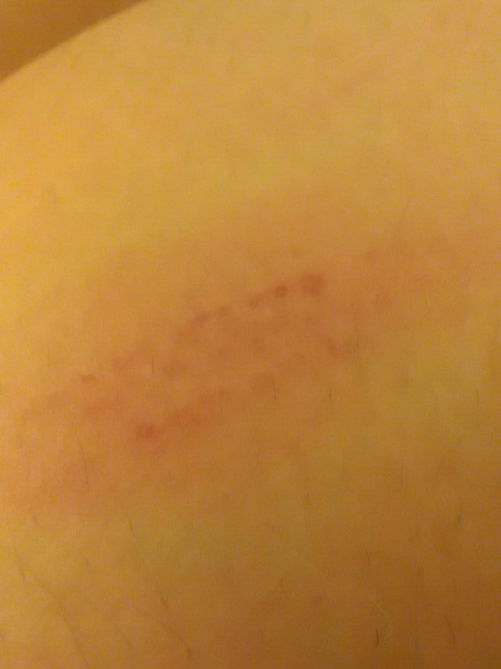 TheBridgeports's tweet photo. Writer hit her leg on wood earlier. Ow. https://t.co/ThFotobuXv