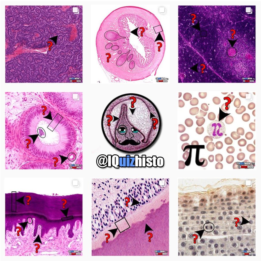 IQuizHisto's tweet photo. *NEW* from the creator of @ihearthisto
Serious about #histology? Exam looming?
Follow @iquizhisto on Instagram for❓galore
#antomy #pathology https://t.co/r7btBD0XgX