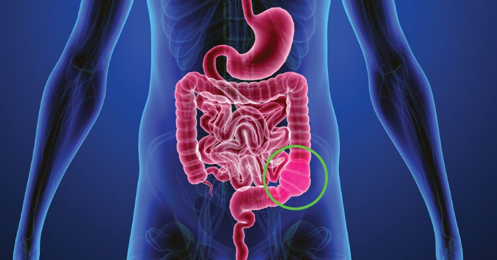 WebMD tweet picture