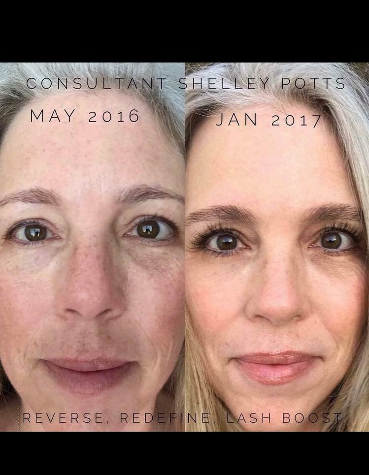klinnsnyder's tweet photo. Why should our face age win the numbers go up?? R+F Redefine is the Anti-Aging product for you. https://t.co/yooiXKF9ae. #eraseyourage https://t.co/0KNqP3GTWu